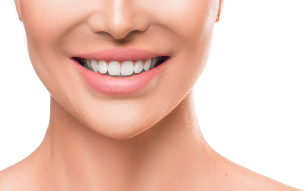 Professional Teeth Whitening At Home Kits What’s Best